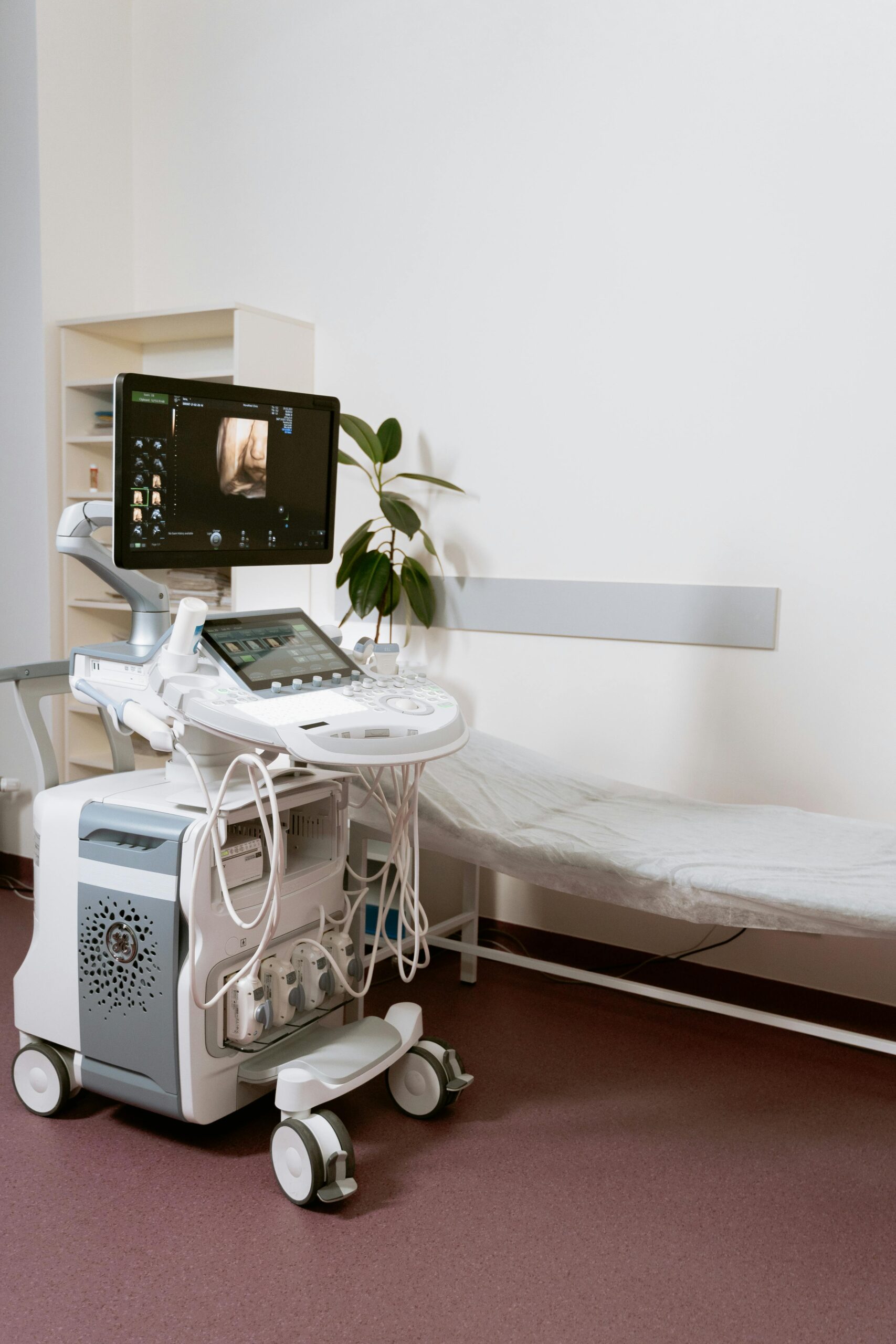 Ultrasound machine setup in a clinic room, ready for patient examination.